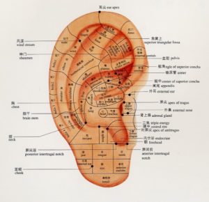 Acupuncture Miami Dr. He - Ear Acupuncture