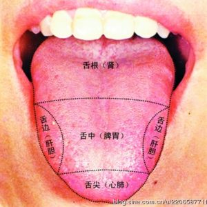 Cancer Acupuncture Holistic Care Dr. He - Traditional Chinese Medicine Tongue diagnosis